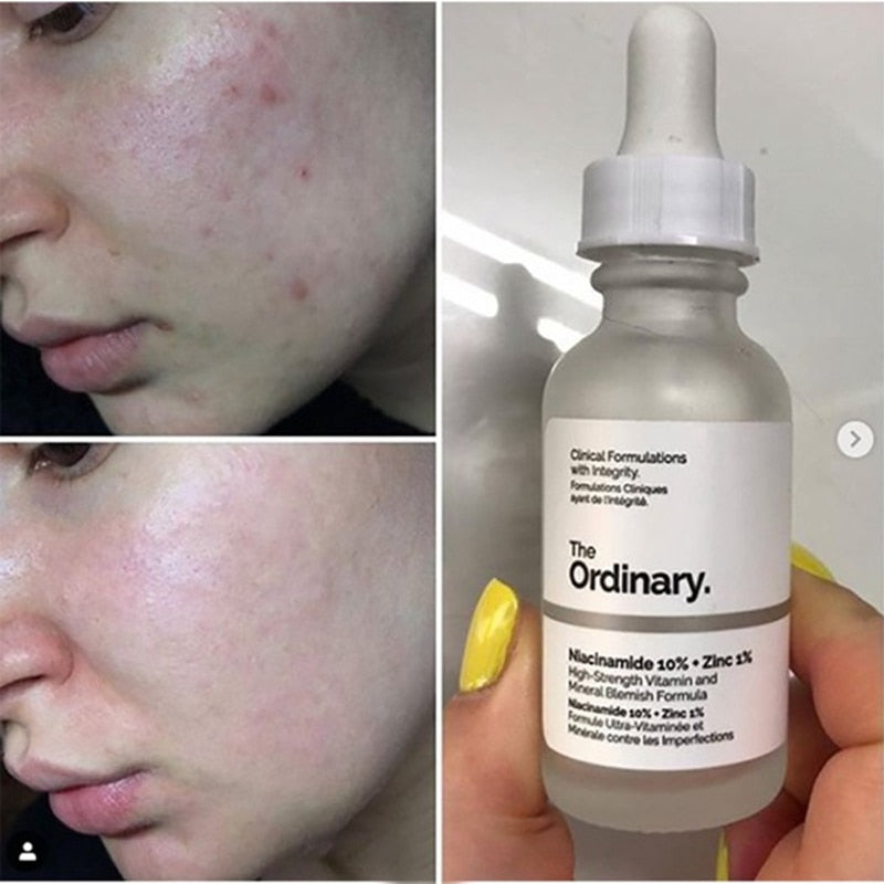 The Ordinary Niacinamide 10% + Zinc 1% 30ml High Mineral Essence Regulates Sebum and Minimizes Pores Makeup Primer Facial Serums